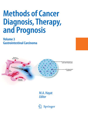 cover image of Methods of Cancer Diagnosis, Therapy and Prognosis